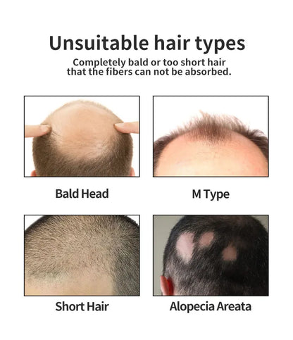 BUNEE Hair Fiber Set 15g: Men's natural hair-dense fibers for balding areas, fills part lines, includes 15g fiber powder