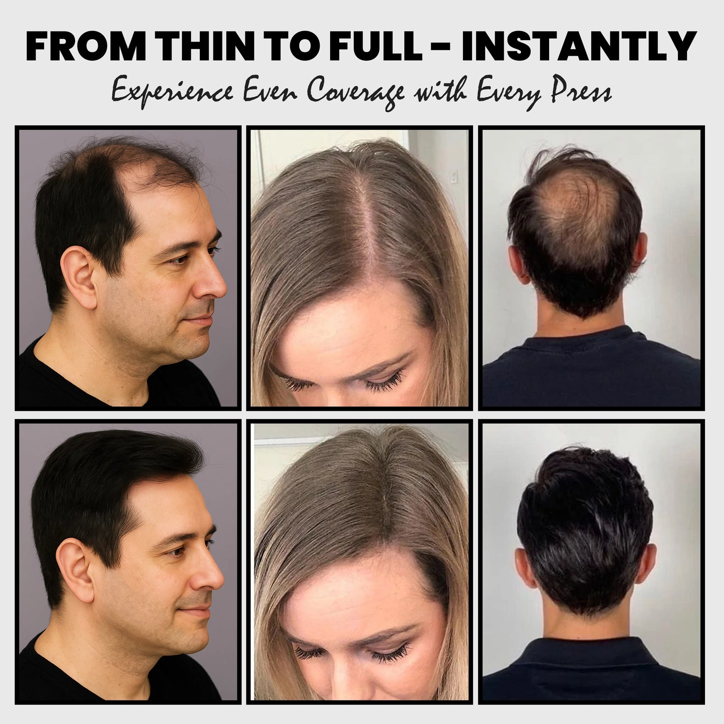 Adglamful 2-In-1 Hair Building Fiber Powder 30g for thinning hair areas, unisex, natural invisible & instant absorption