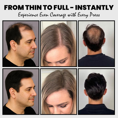 Adglamful 2-In-1 Hair Building Fiber Powder 30g for thinning hair areas, unisex, natural invisible & instant absorption