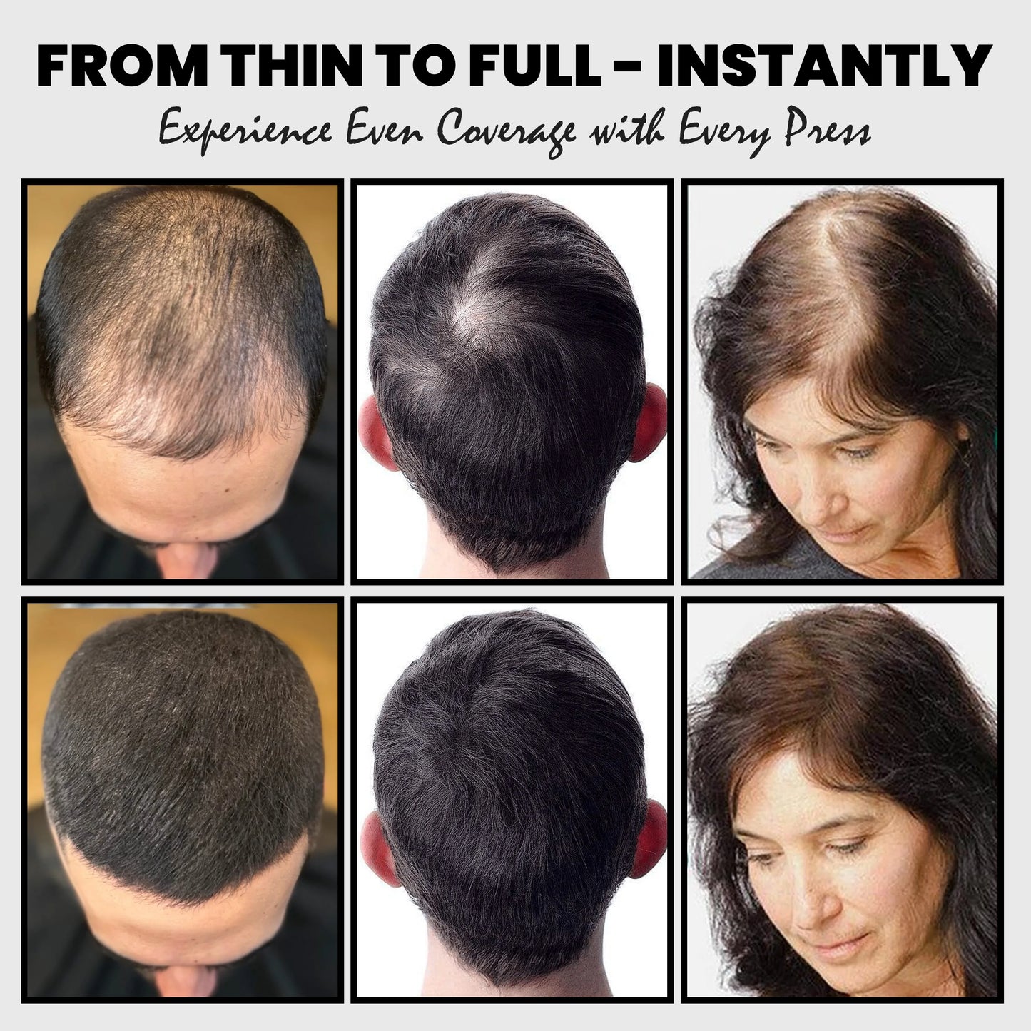 Adglamful Hair Fibers (15g) – 10sec Instant Volume, Spray Applicator for Thinning Hair | Invisible & Even Coverage