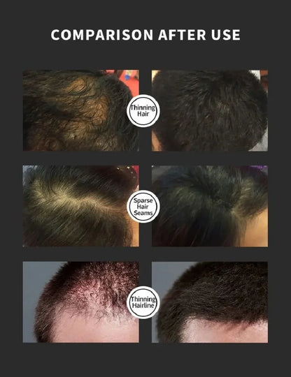 Hair Fiber Powder Hair Seams Covers Fiber Powder Hair Powder Can Hair Full-Bodied Waterproof Hair Powder Auxiliary Nozzle Set
