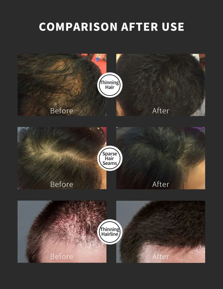 BUNEE Hair Building Fiber Natural Keratin Fiber for Fills Part Lines Instant Hair Thickening Powder Dense Hair Growth Styling