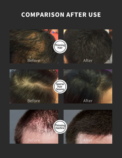 BUNEE Hair Building Fiber Natural Keratin Fiber for Fills Part Lines Instant Hair Thickening Powder Dense Hair Growth Styling